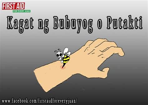 Kagat ng bubuyog o putakte .